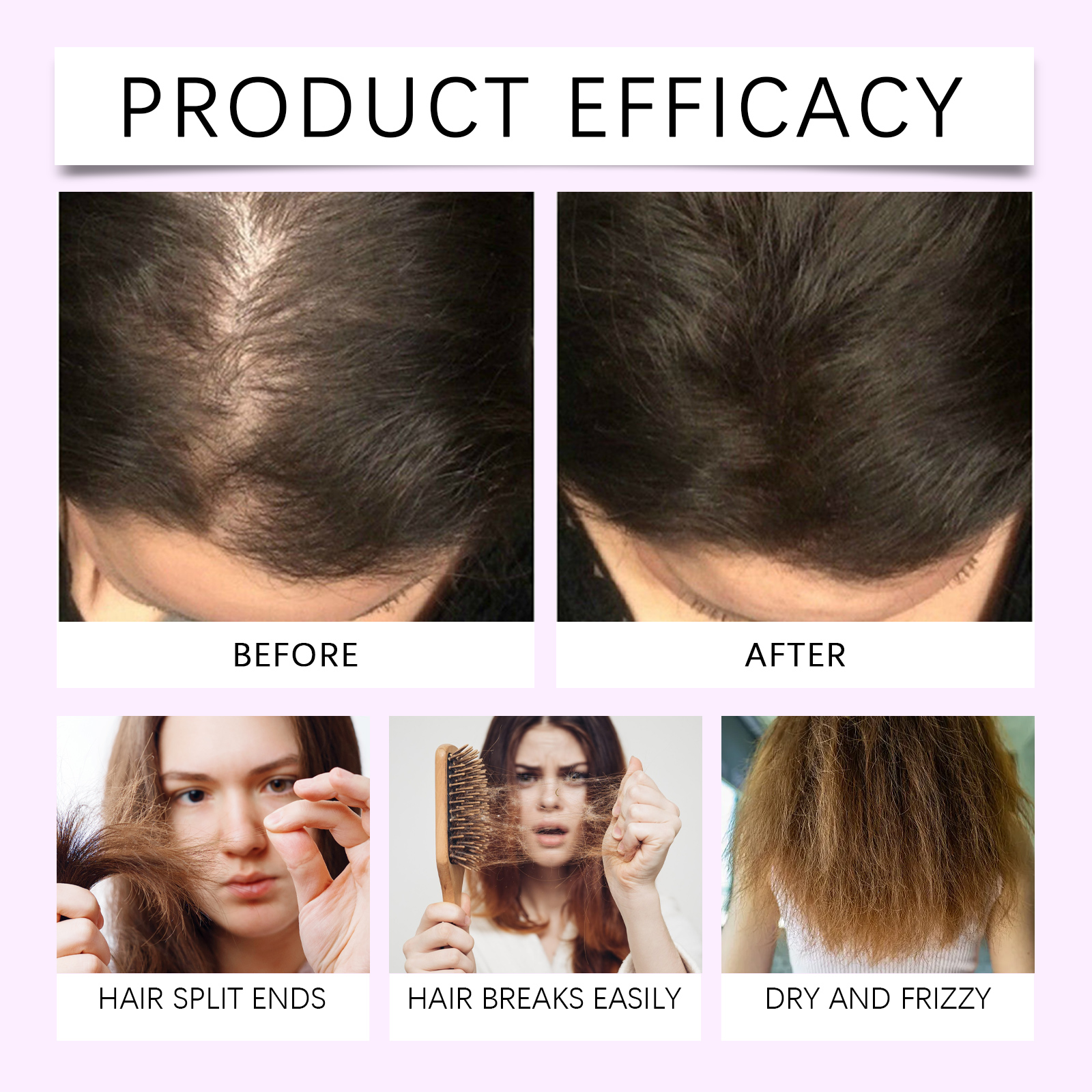Hair Nourishing Roller Essence Mild Ingredients Care Nourish Scalp Soft Shiny Hair Protect Hair