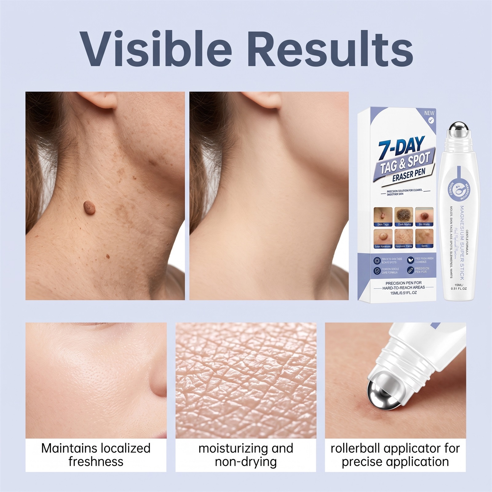 Skin Magnesium Oil Care Pen Mild Formula Nourish Body Skin Smooth Rejuvenate Moisturize Care Skin
