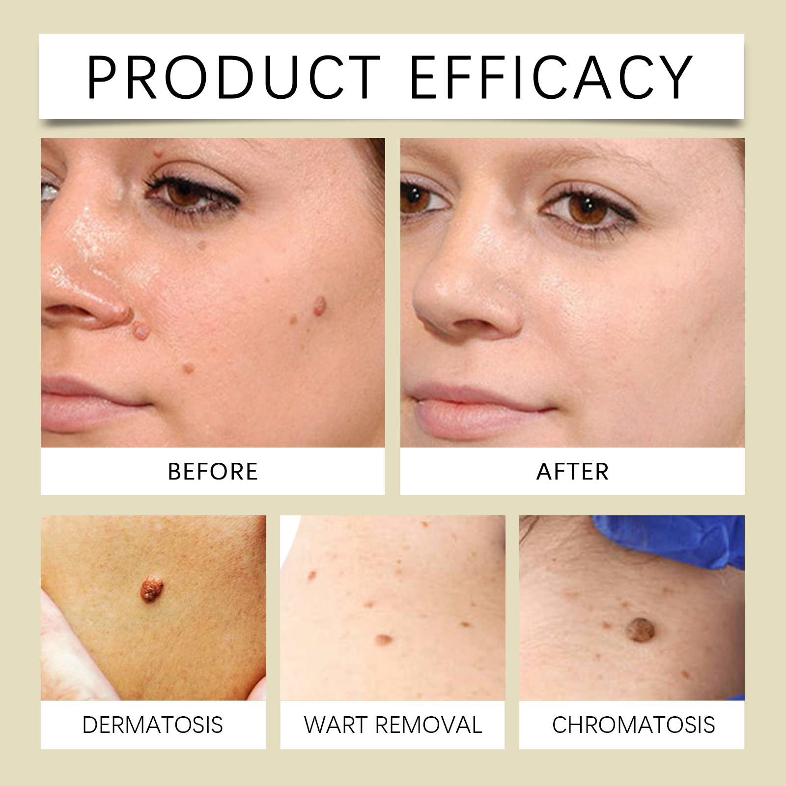 Bee Venom Skin Care Cream Body Skin Clean Remove Warts Smooth Body Skin Care Lotion