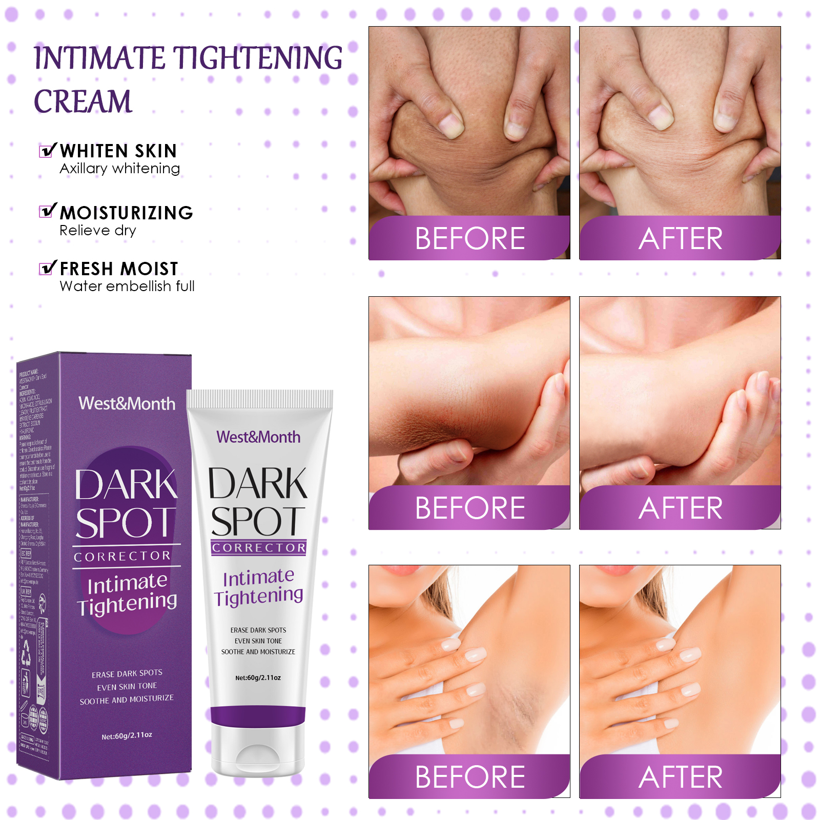 Body Moisturizing Cream Kojic Acid Niacinamide Brightening For Underarm Elbow Knee Even Tone Daily Skin Care 60g