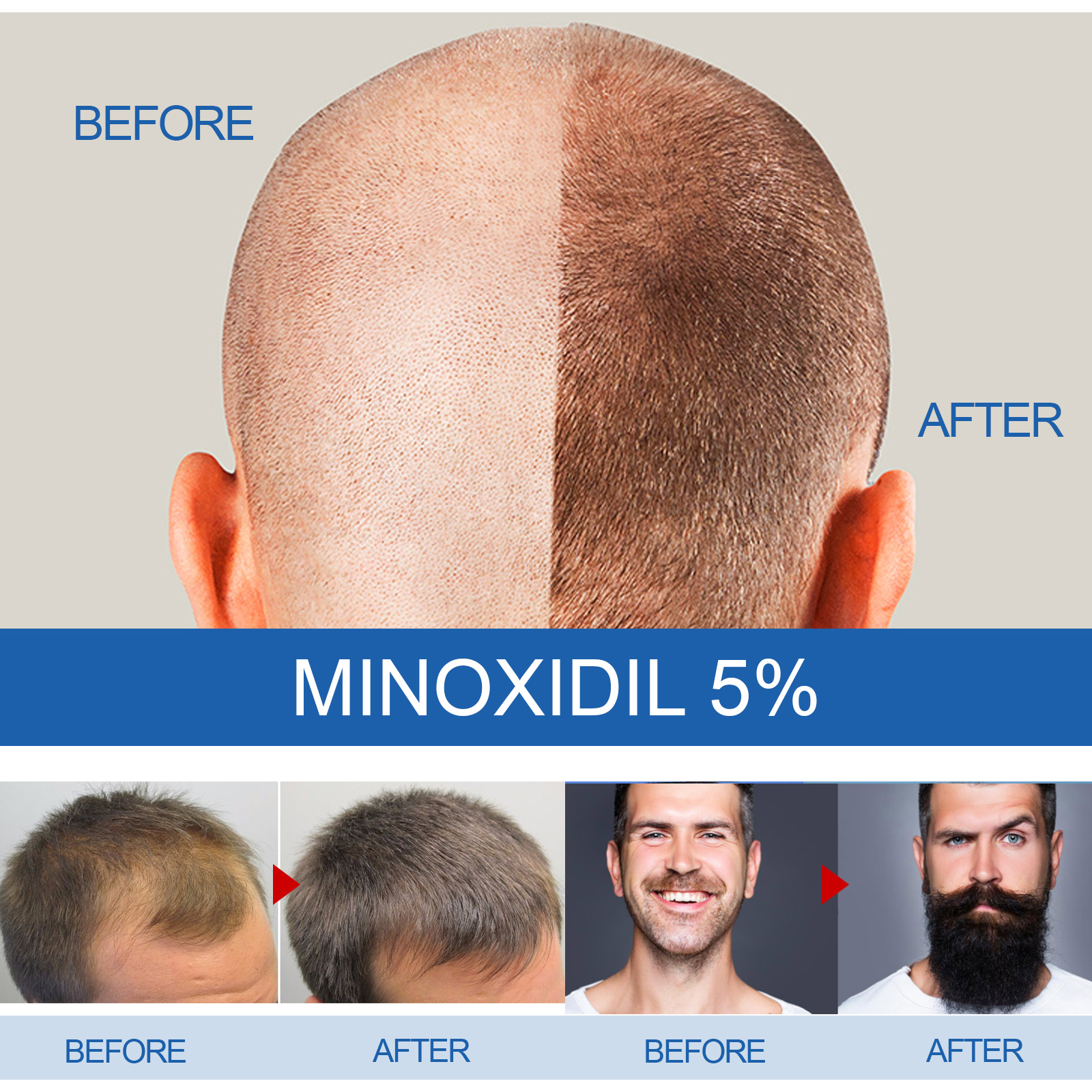 Men Hair Care Liquid Scalp Nourishing For Hair Beard Shine And Follicle Care Daily Treatment