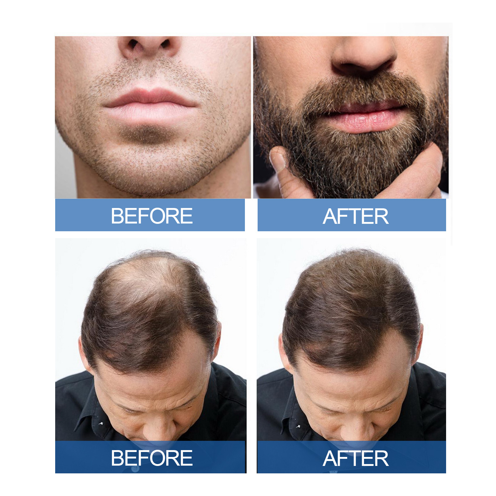 Men Hair Care Liquid Scalp Nourishing For Hair Beard Shine And Follicle Care Daily Treatment