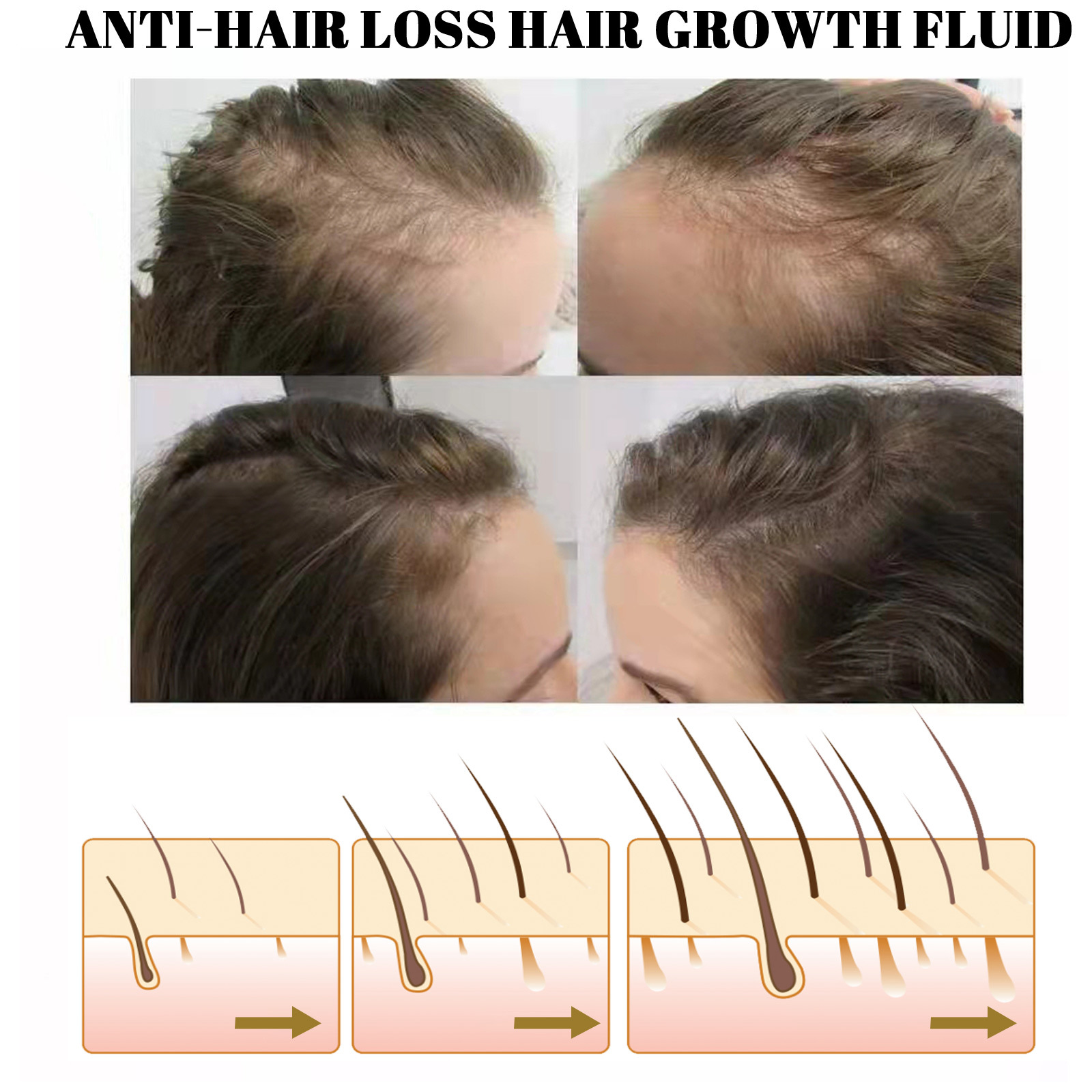 Hair Growth Essential Oil Essence Original Authentic Prevent Hair Loss Liquid Care Beauty Hair Growth Spray Hair Care Serum 30ml
