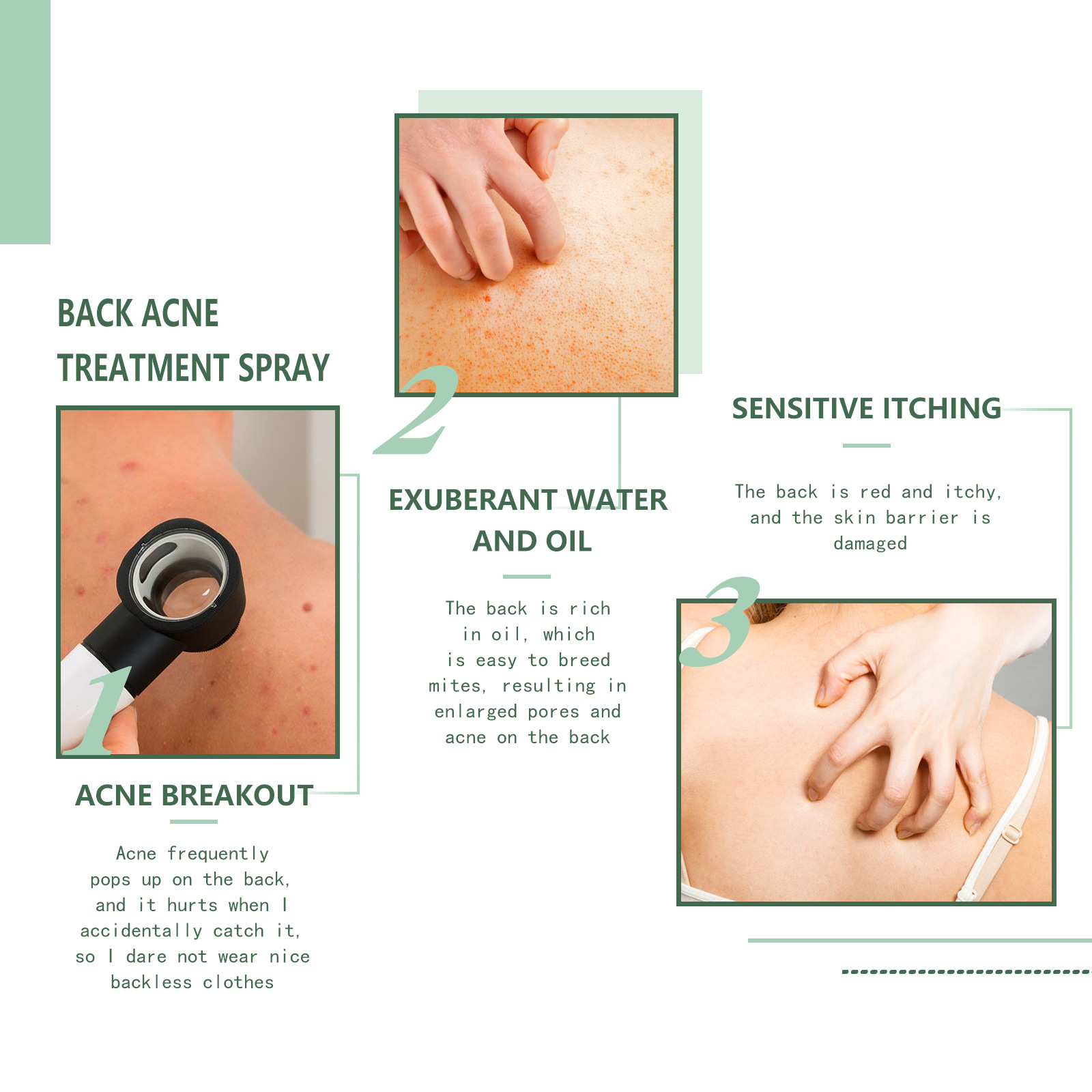 (1 PC) Back Care Spray Back Acne Remover Spray Shoulder Pimple Repair Whiteheads Treatment Blackhead Anti Mites Oil Control Hydrate Body Soothing Serum