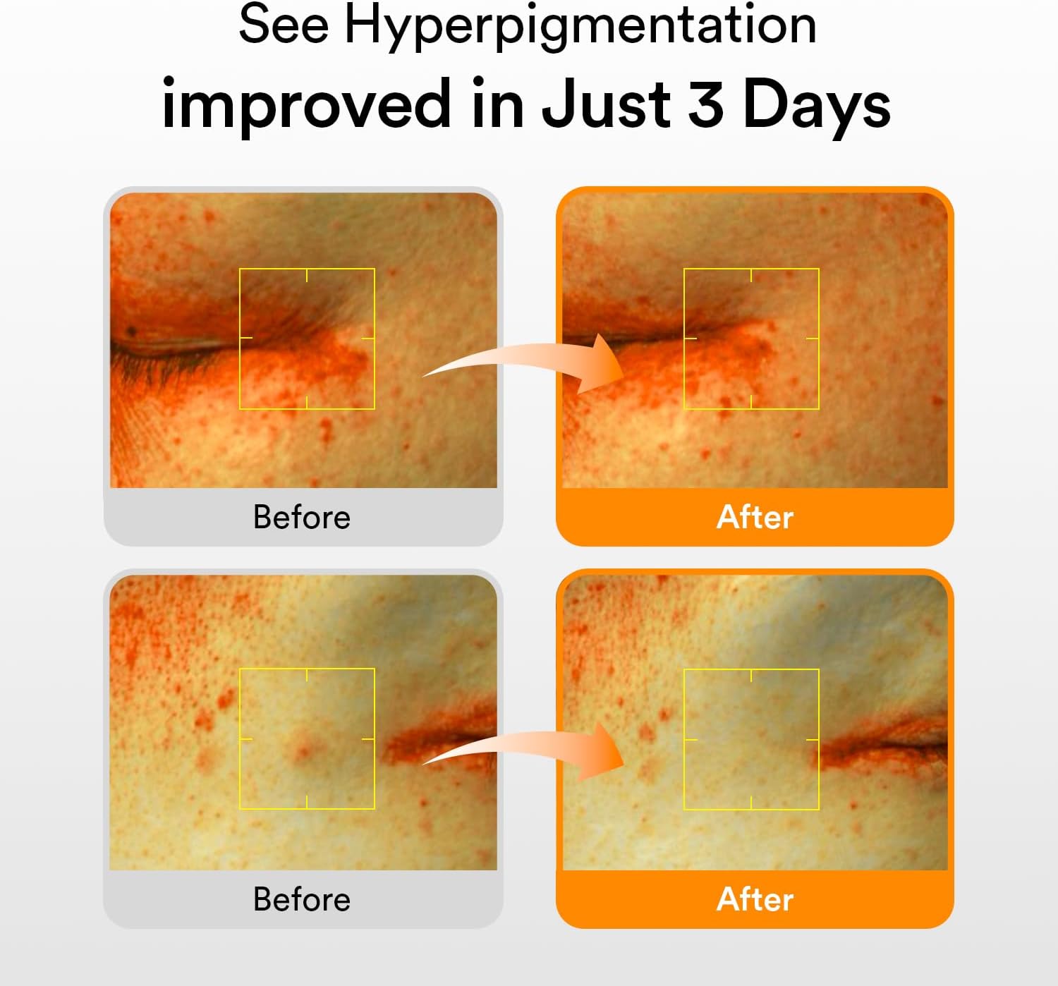 Abib Glutathiosome Dark Spot Serum Vita drop 50ml Korean Skincare Dark Spot Hyperpigmentation Treatment Serum for Sensitive Uneven Skin