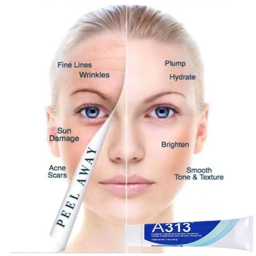 Pharma Developpement - A313 Vitamin A Retinol Cream 50g