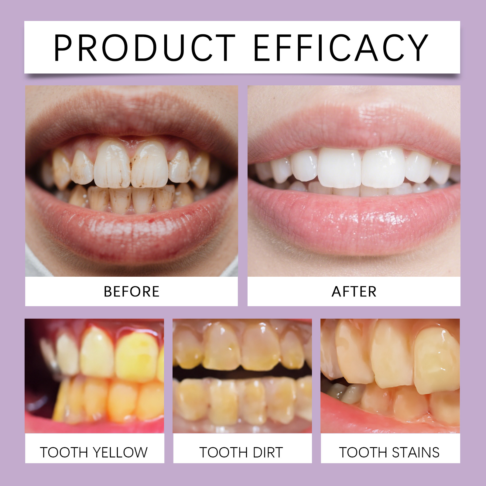 Mint Foam Mousse Toothpaste Cleanses Brightens Teeth Gentle Cares Oral Freshens Breath