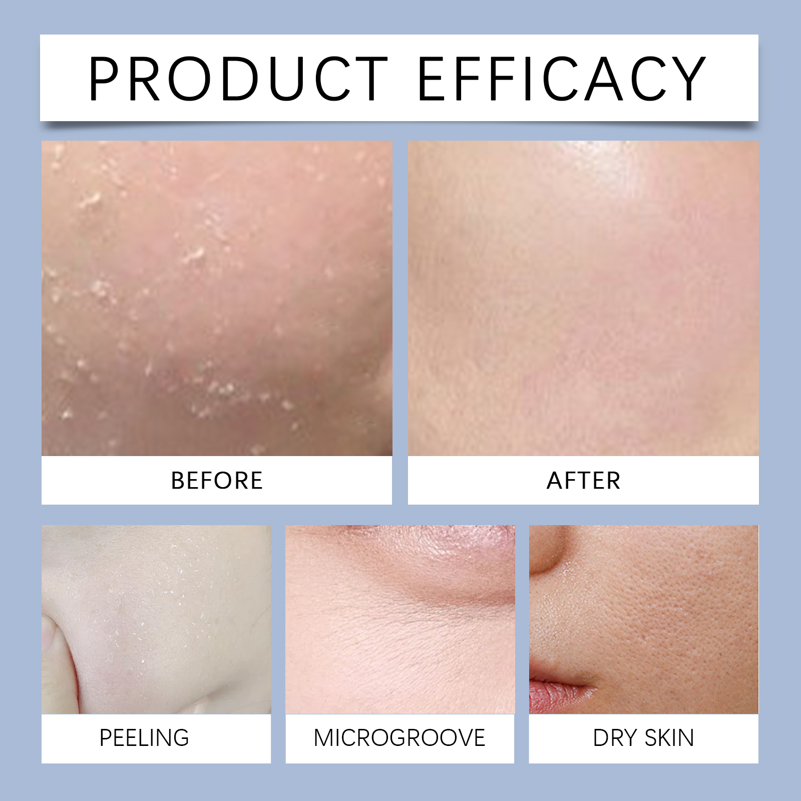 Collagen Hydrating Mask Fades Fine Lines Hydrates Tightens Moisturizes Improves Skin Condition Texture Elasticity