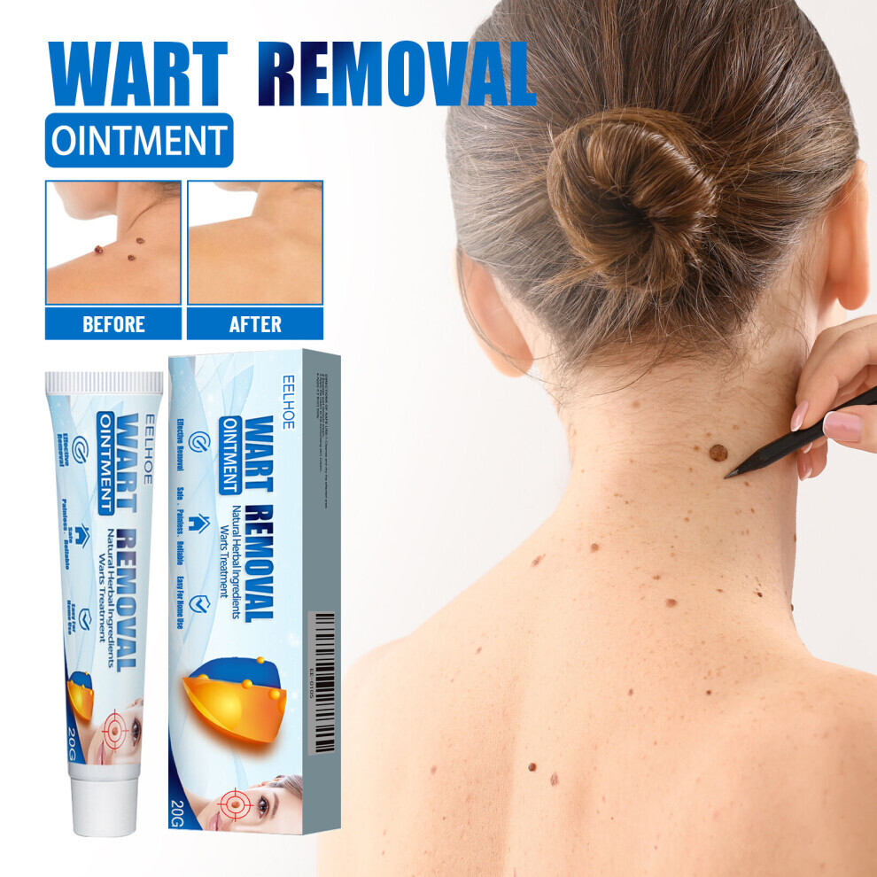 Wart Remover Cream 20g Fast Acting Gel Wart ACare Ointment for Face Hands Feet Body