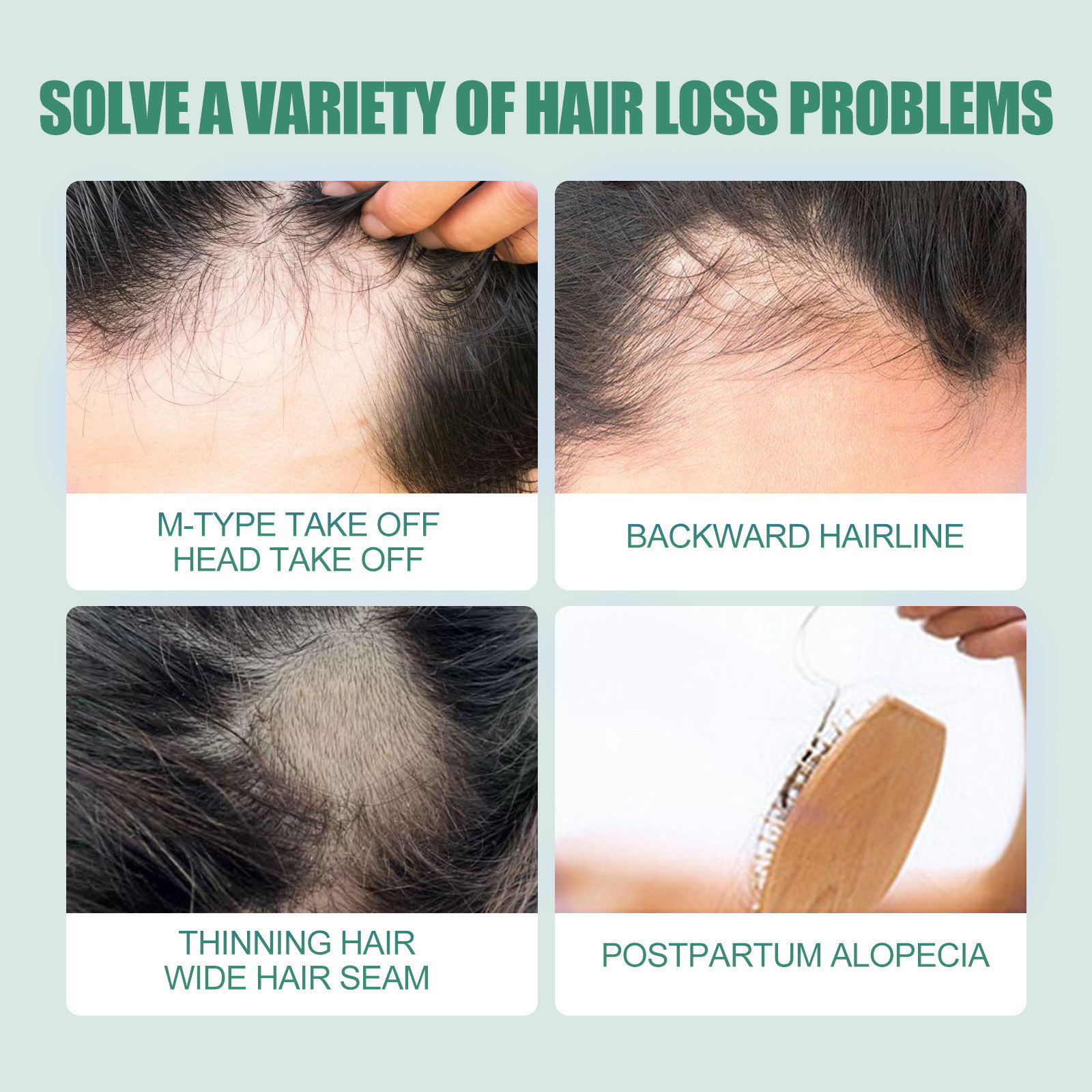 Ginger Hair Growth Serum 7 Days Prevent Hair Loss Essential Oil Fast Beard Hairline Growing Scalp Treatment for Women Men 30ml