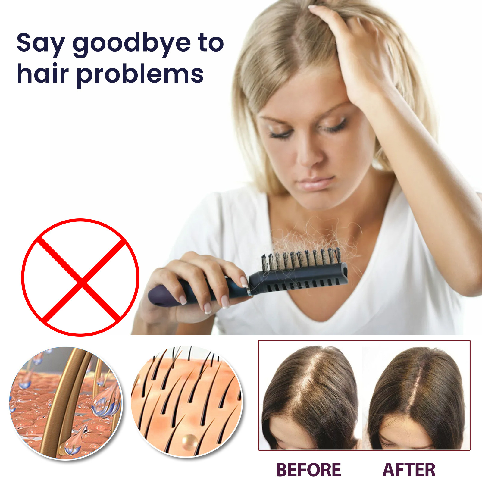 Hair Lotion Serum Essence Oil Hair Applicator Hair Growth Treatment Hair Anti Hair Loss Spray Stripping and Repairing Damaged Hair Roots for Men Women