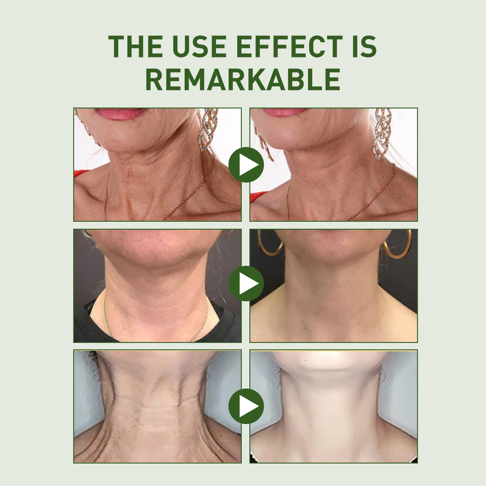 Neck Cream Neck Skin Firming Tightening Cream Neck Line Lifting Essence Moisturizing Cream Repairs Dullness  Dark Neck Lines Gone Face Skin Care