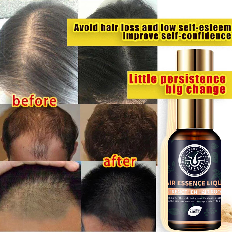 Snime Hair Essence Liquid Hair Serum Provide Nutrition Repair Spray 30ml