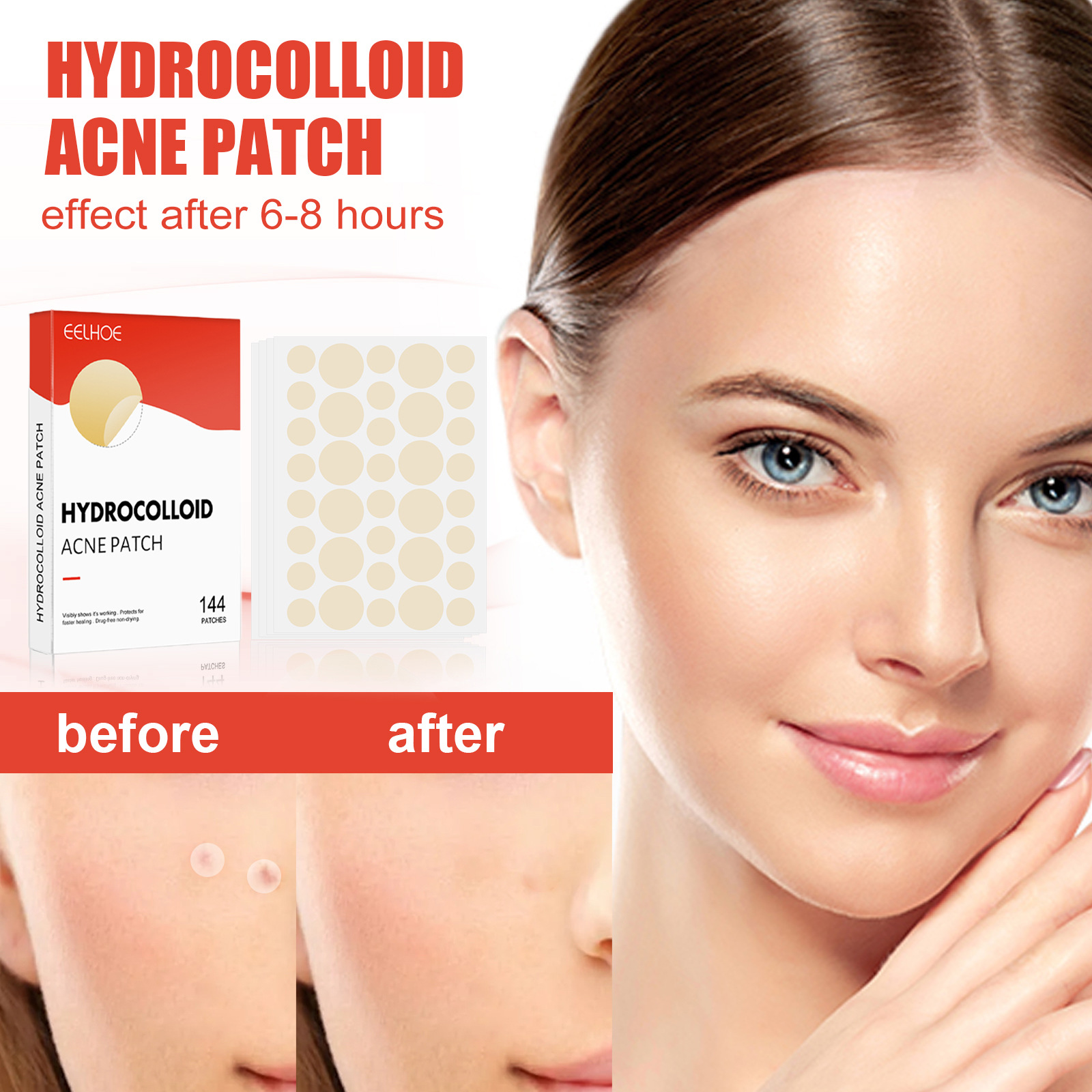 Hydrocolloid Acne Pimple Patch 144pcs Set Invisible Healing Absorbing Spot Sticker Covering Men Women Face Spot Scar Care Acnes Face Skin Care