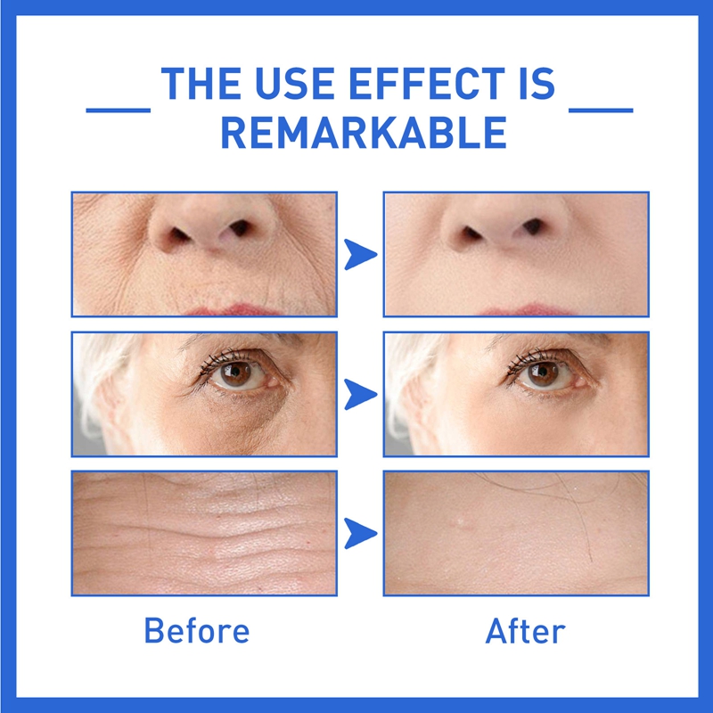 Anti-Aging Collagen Serum Wrinkle Remover Facial Brighten Fade Fine Lines Whitening Cream Skin Care