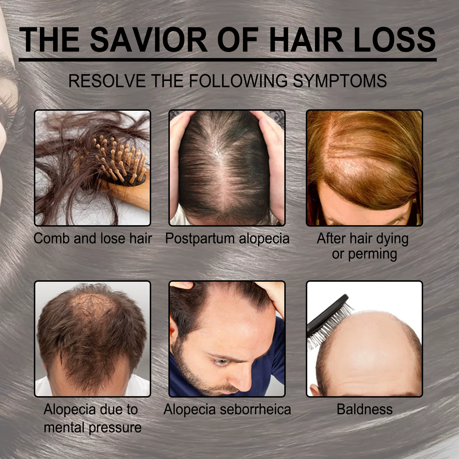 Rosemary Essential Oil Nourishes Repairs Improves Frizz Prevents Hair Loss