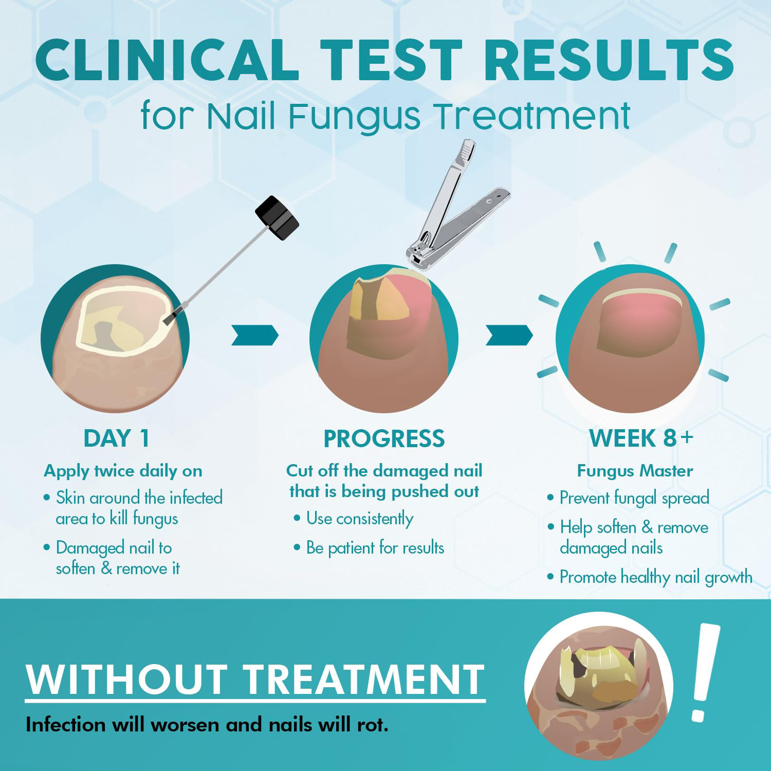 Toenail Fungus Treatment Nail Fungal Renewal Solution Nail Repair Liquid Nail Care 20ml