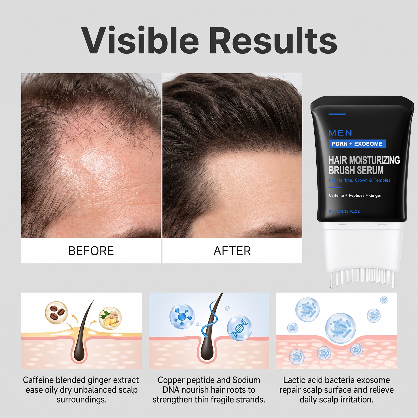 Men Scalp Care Essence Mild Protect Fresh Non Greasy Balance Oil Water Gloss Hair Full Scalp