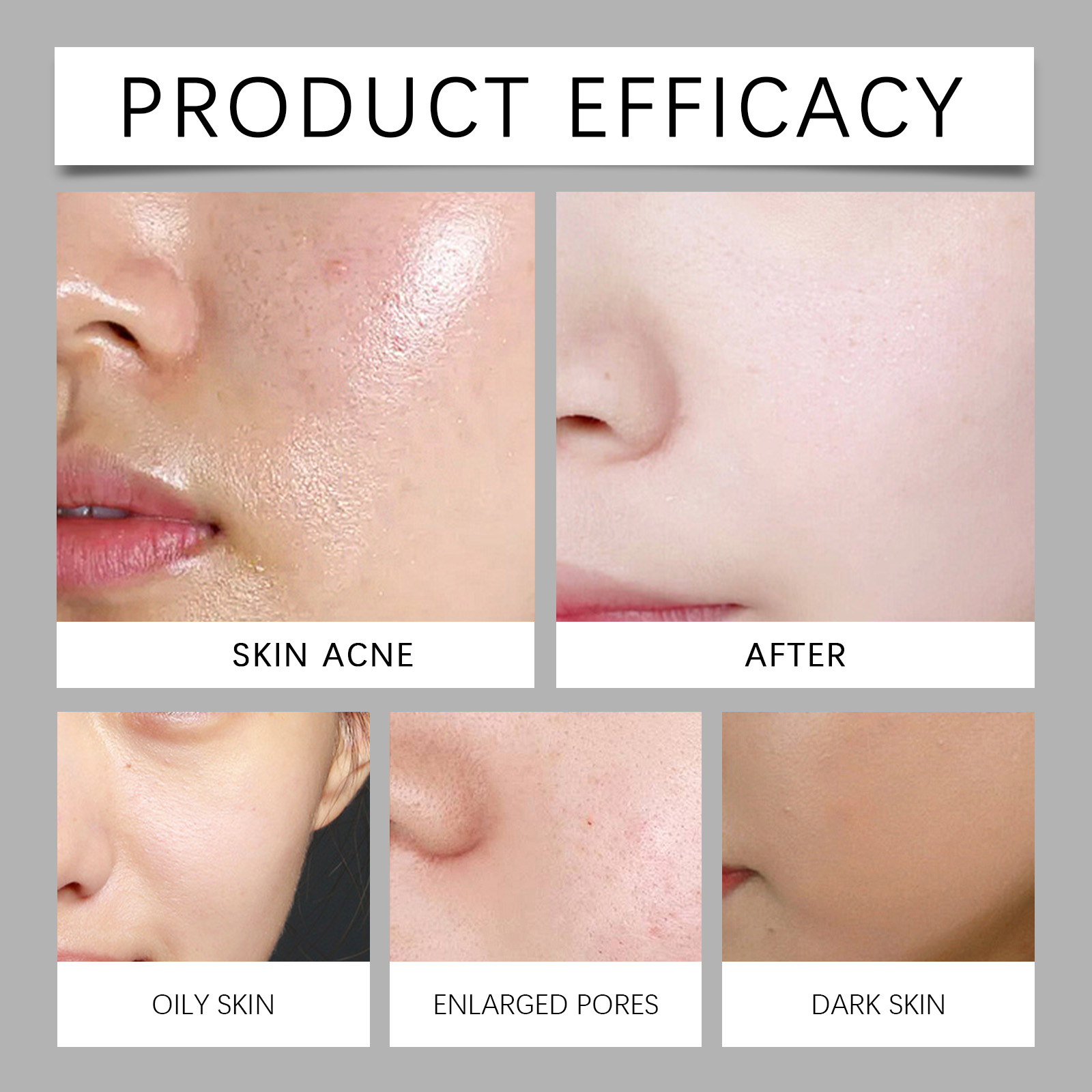 Exfoliating Black Rice Essence Moisturizes Hydrates Facial Skin Moist Bright Smooth Delicate