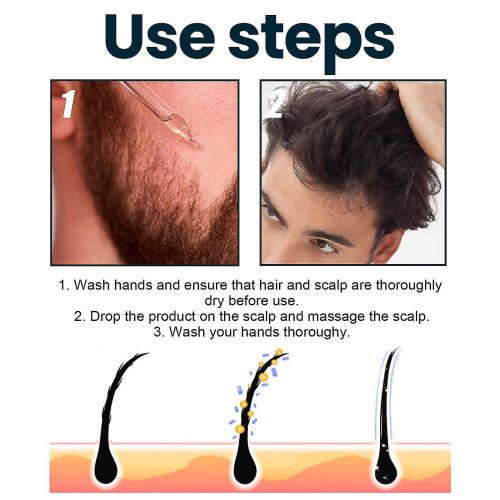 5 Percent Extra Strength Signature Extra Strength Hair Regrowth Treatment For Men