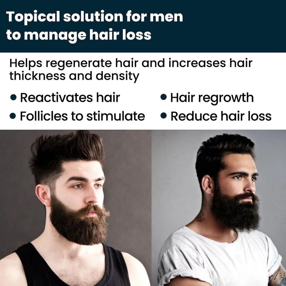 5 Percent Extra Strength Signature Extra Strength Hair Regrowth Treatment For Men