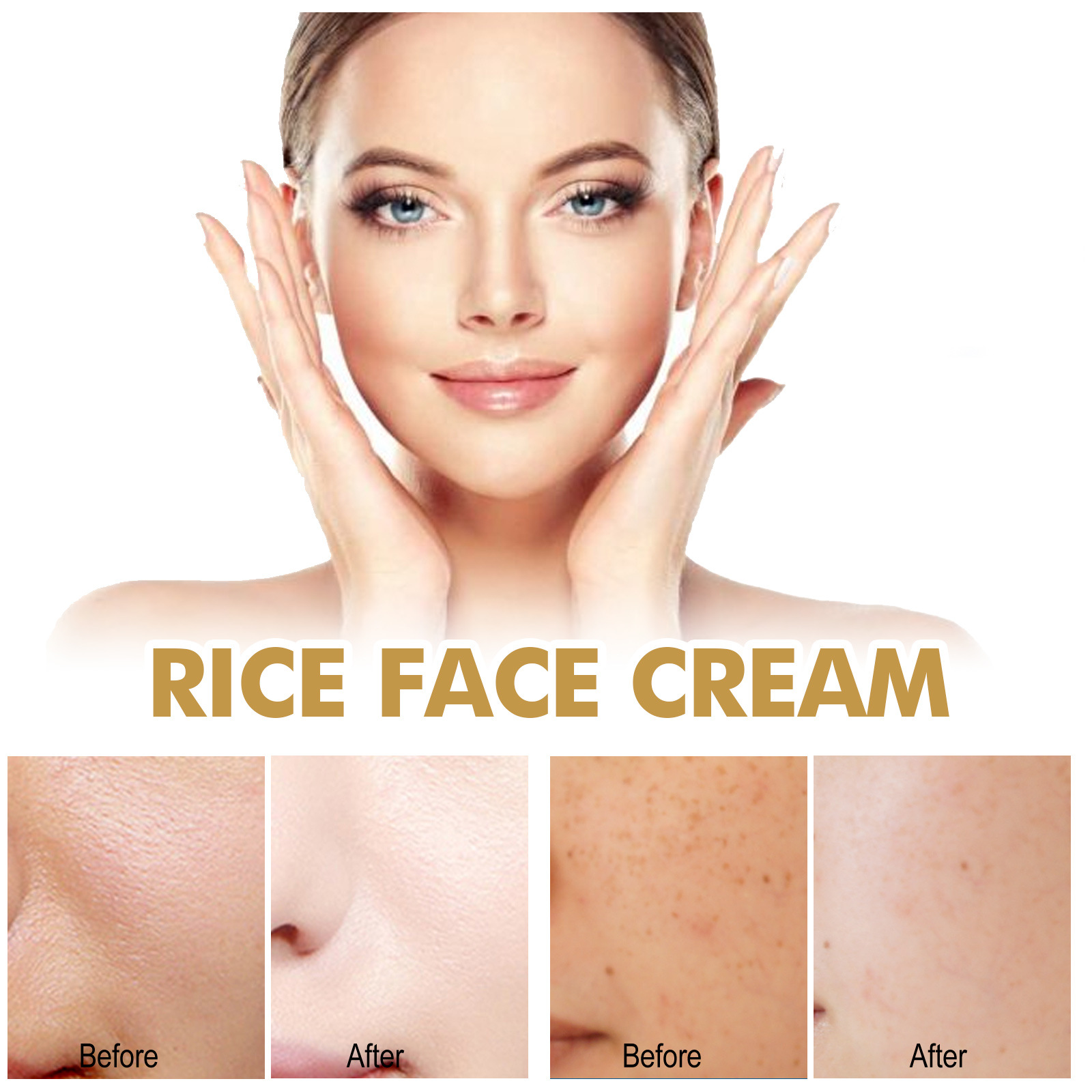 Rice Face Cream Anti Dark Spots Cream Brighten Whitening Melasma Freckles Blemish Remove  Melanin Pigmentation Corrector