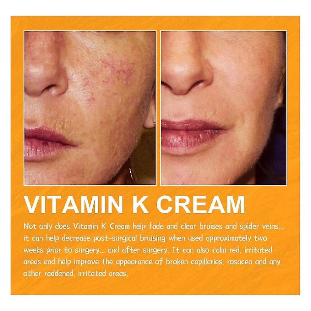 Vitamin K Cream For Repair Cream for Spider Veins Dark Circles Discoloration 60g