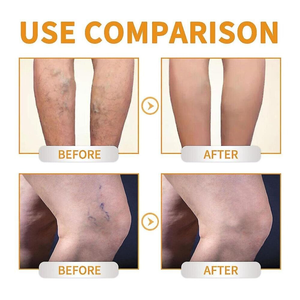 Vitamin K Cream For Repair Cream for Spider Veins Dark Circles Discoloration 60g