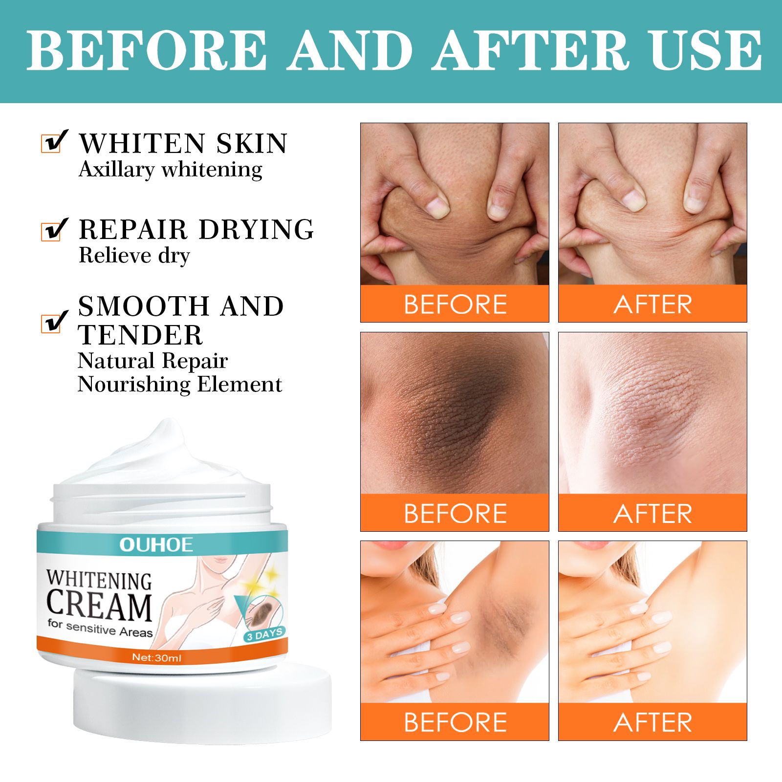 Underarm Brightening Cream For Dark Spots Elbows Knees Moisturizing And Even Tone Daily Skin Care 30ml