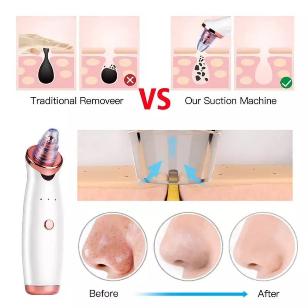 Skin Microdermabrasion Rejuvenation Kit