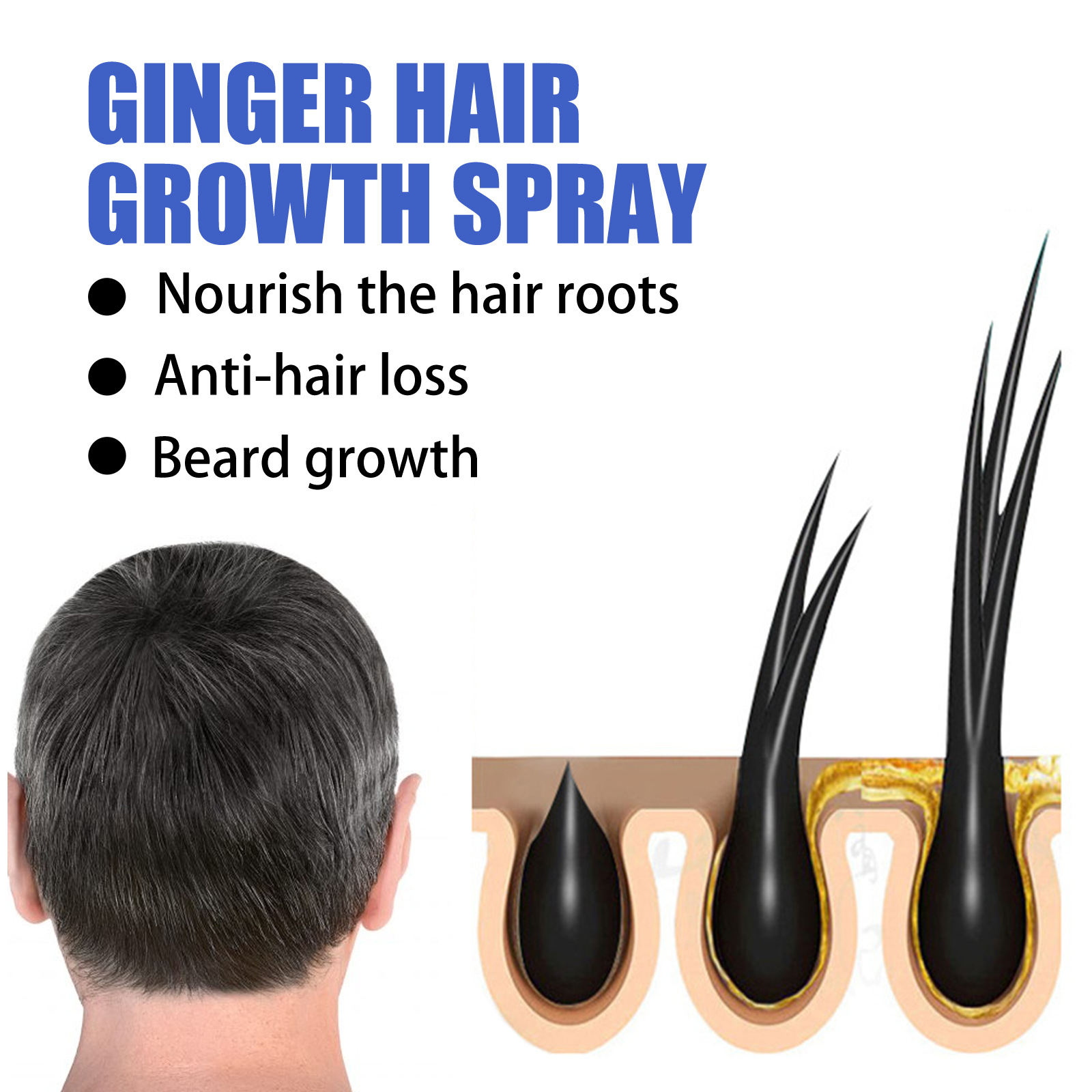 Ginger Hair Growth Spray Scalp Massage Hair Care Nutrient Solution 30ml
