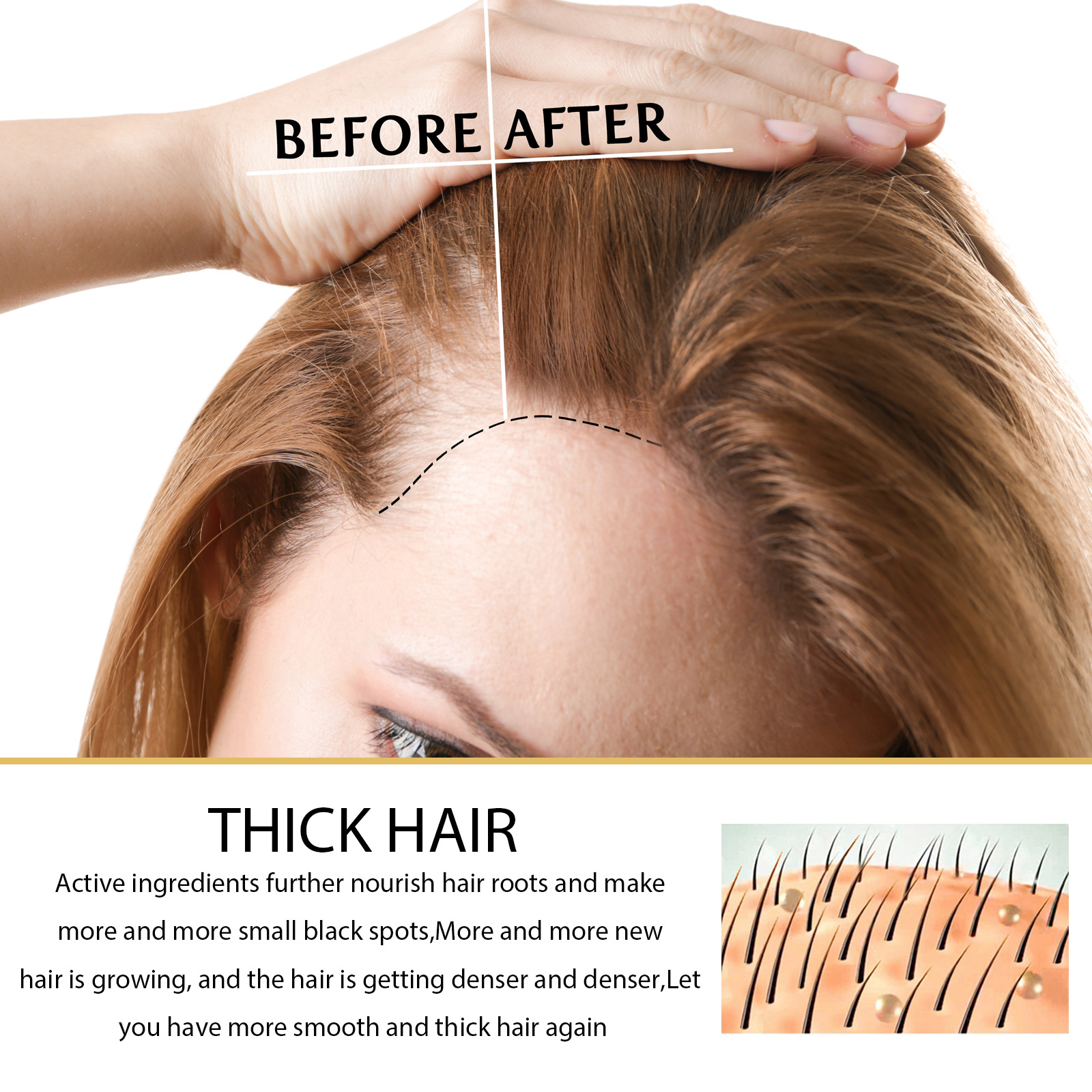 Hair Growth Serum Hair Growth Oil Anti-Hair Loss Nourishing Hair Roots Reapir Scalp Care Products Anti Thinning Hair Treatment Hair Regrowth Treatment