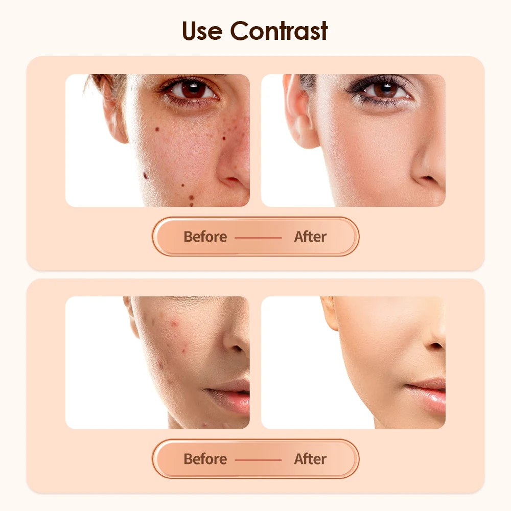 Electric Plasma Pen 9 Modes Auto Blackhead Skin Tag Mole Removal Neck Wart Freckle Nevus Dark Spot Black Dots Face Beauty Skin Care Machine LCD Display