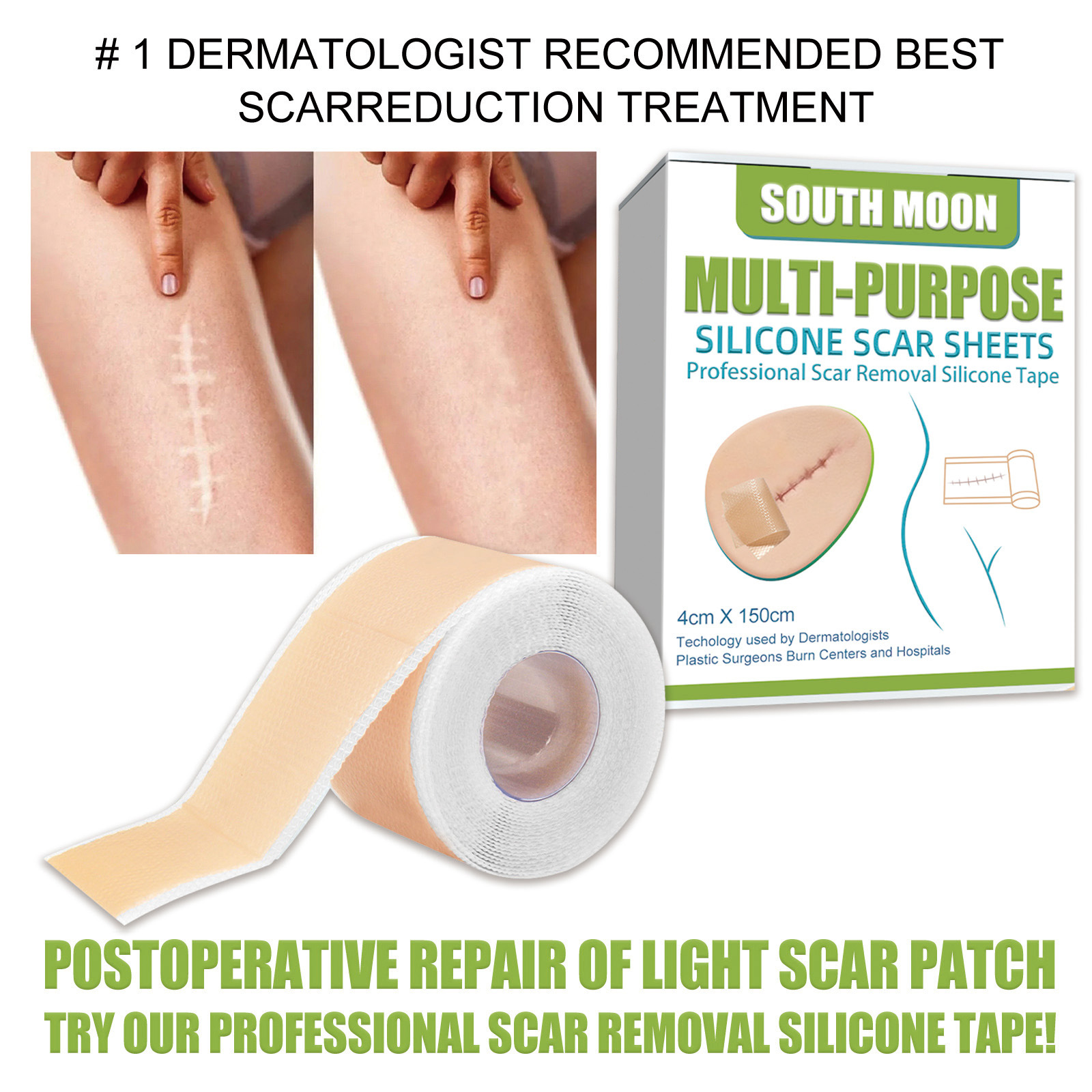 South Moon Silicone Scar Sheets Multi Purpose Self Adhesive Scar Cover Tape Removal Tape Acne Trauma Burn Scar Skin Repair Scar Patch Treatment Beauty Skin Care