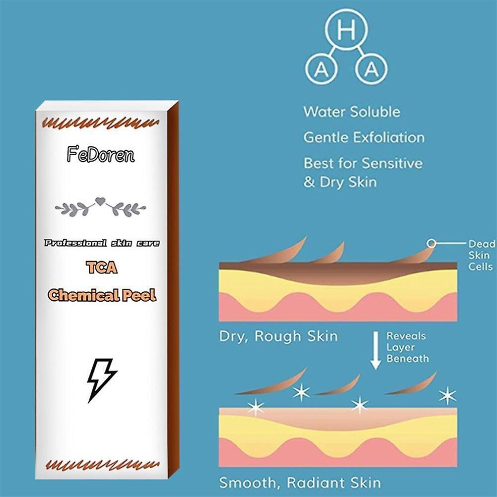 Tca 30 Percents  Tca Peel Acid Peeling Acid Skin Superforce Peeling Pigmentation Acne Scar