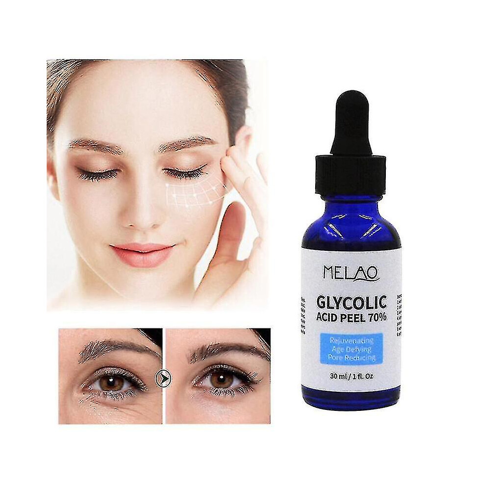 Glycolic Acid Peel Purity 70 Concentration 5 Skin Repair Invisible Pores Brighten Skin Tone Treat Acne Mild And Non-irritating-mxbc