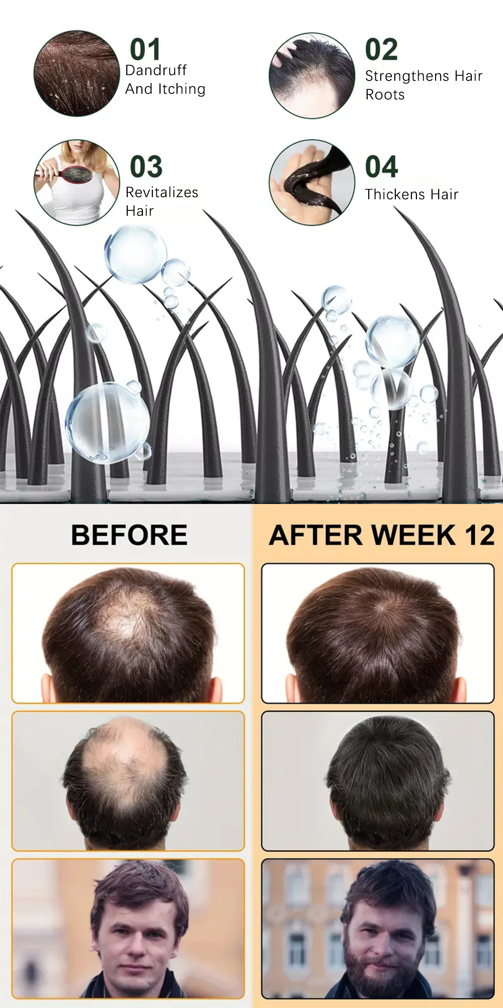 SUAI Hair Essential Oil Ginger Anti Hair Loss Repair Care Nourish Hair Growth Products