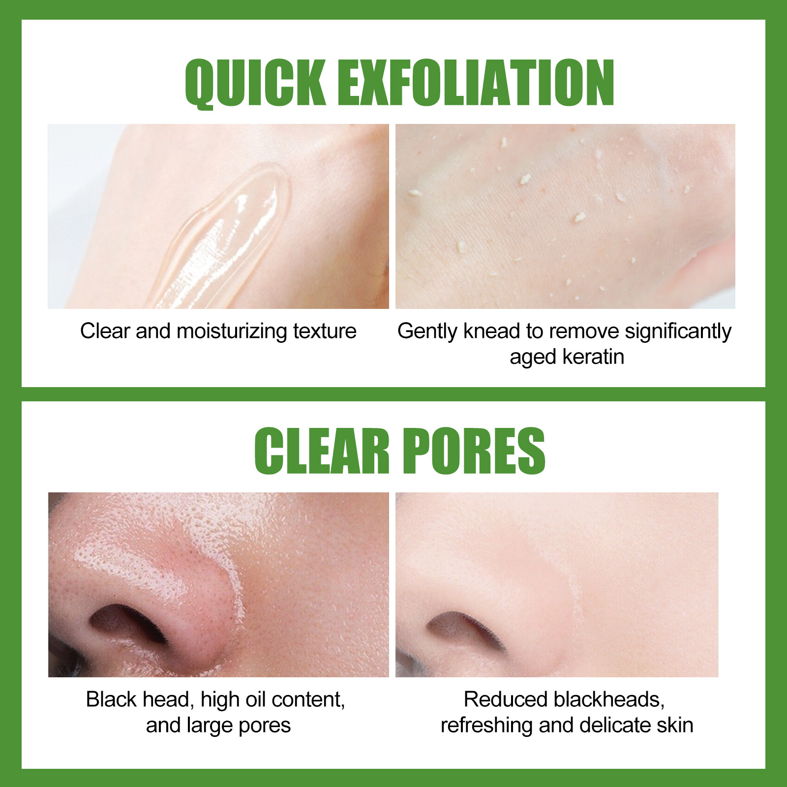 Aloe Exfoliator Gel Face Exfoliating Cream Shrink Pore Blackhead Acne Treatment Scrubs Dead Skin Removal Smooth Whitening Moisturizing Peeling Gel
