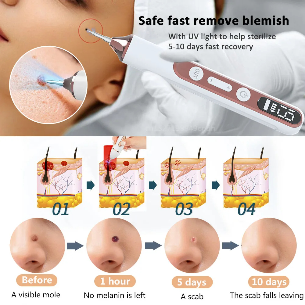 Black Dots Remover by Plasma Pen Beauty Skin Care Products Skin Tag Removal Face Cleaning Tools Tattoo Freckle Dark Spot Mole Warts Eliminator Machine