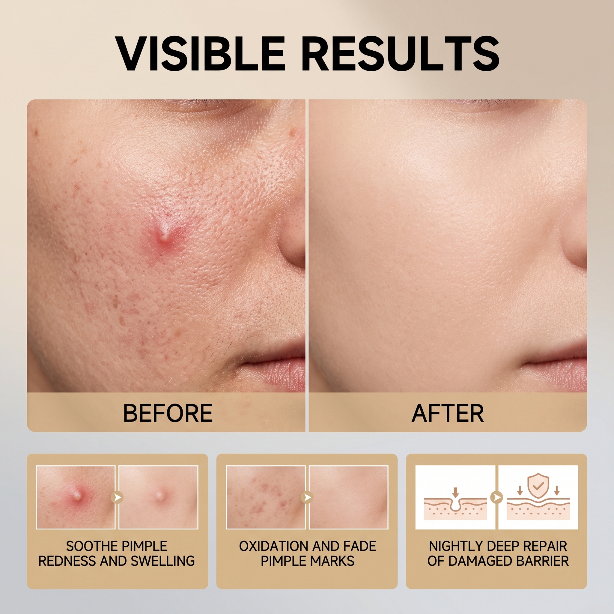Night Skin Care Ointment Mild Moisturizing Hydrating Refreshing Cozy Portable Facial Acne Daily Skin Treatment
