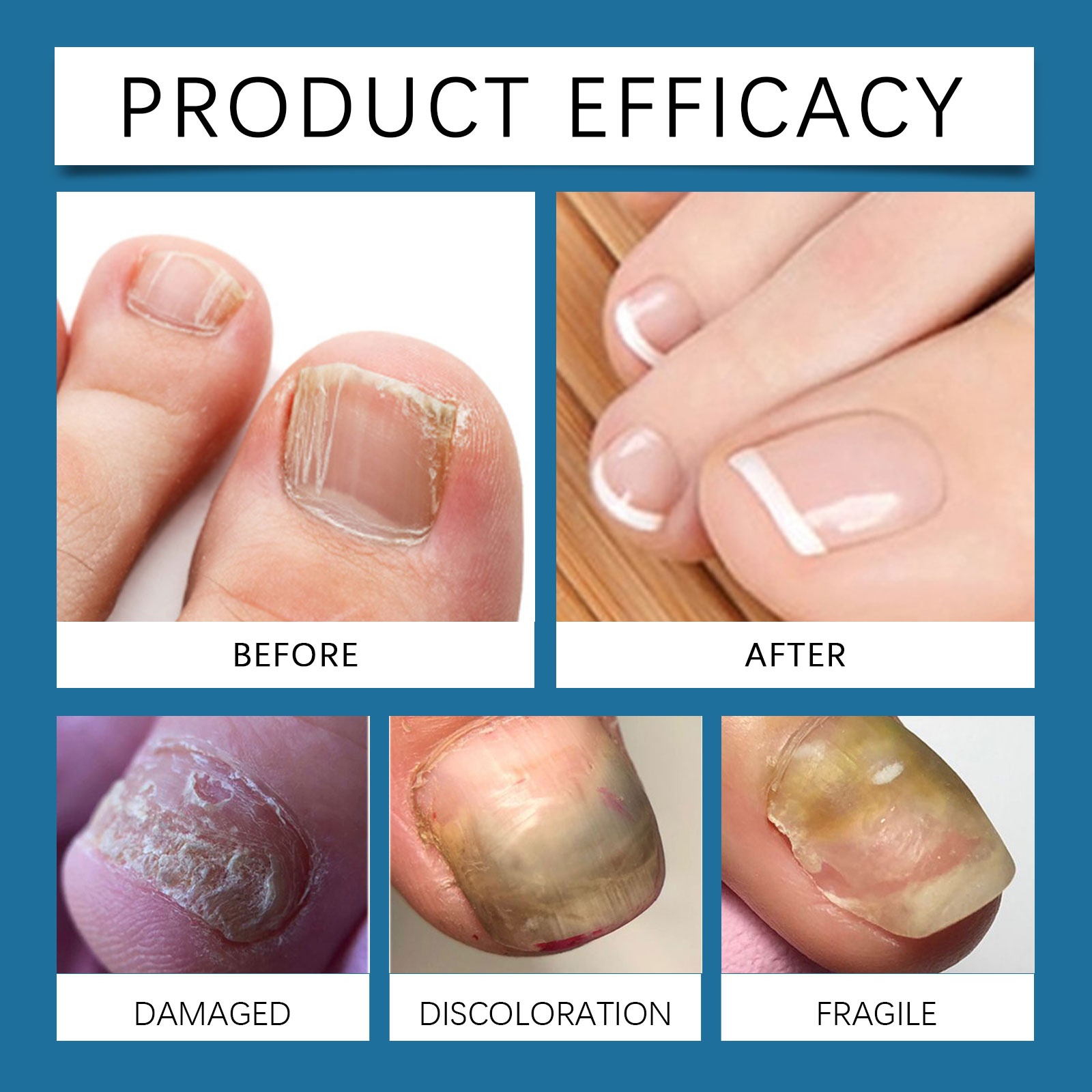 Nail Care Spray Gentle Nourishing Cleansing For Hand Foot Nail Daily Moisturizing Protection