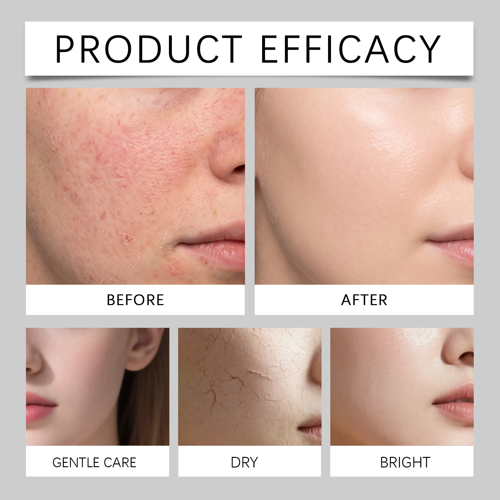 Centella Moisturizing Cream Plant Extract Silky Light Texture Facial Skin Delicate Elastic Care Cream