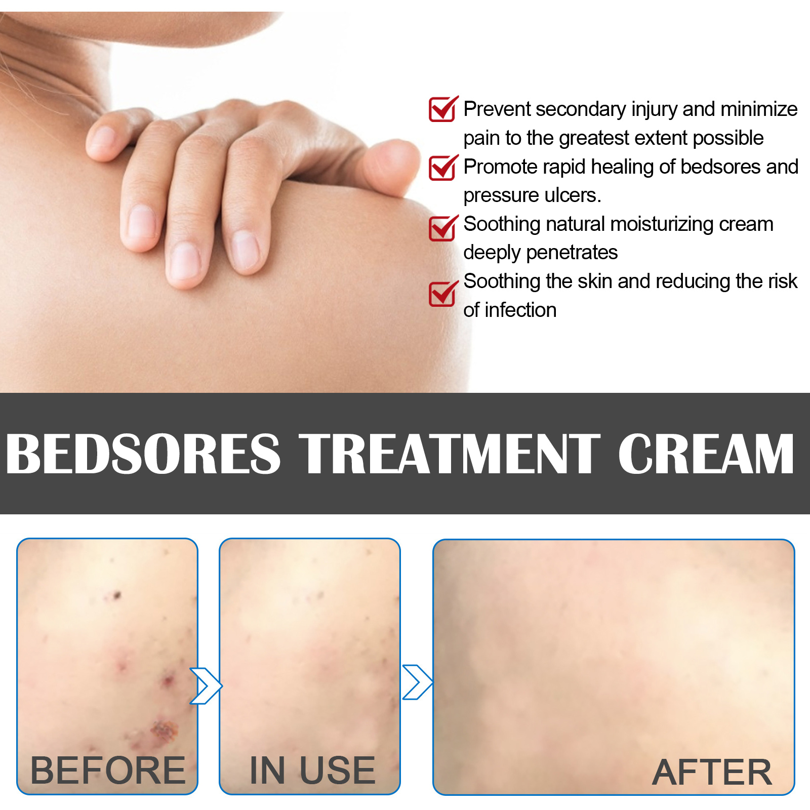 Skin Care Cream Soothing Moisturizing Barrier Support For Daily Body Skin Nourishment 20g