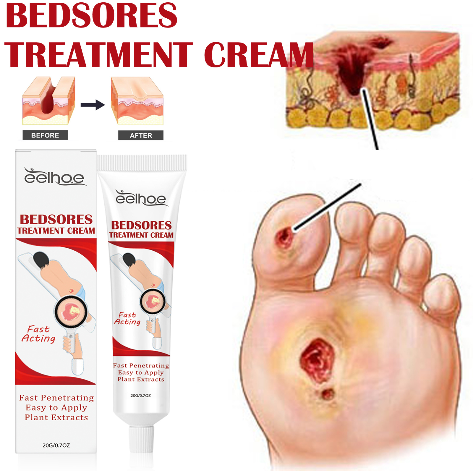 Skin Care Cream Soothing Moisturizing Barrier Support For Daily Body Skin Nourishment 20g