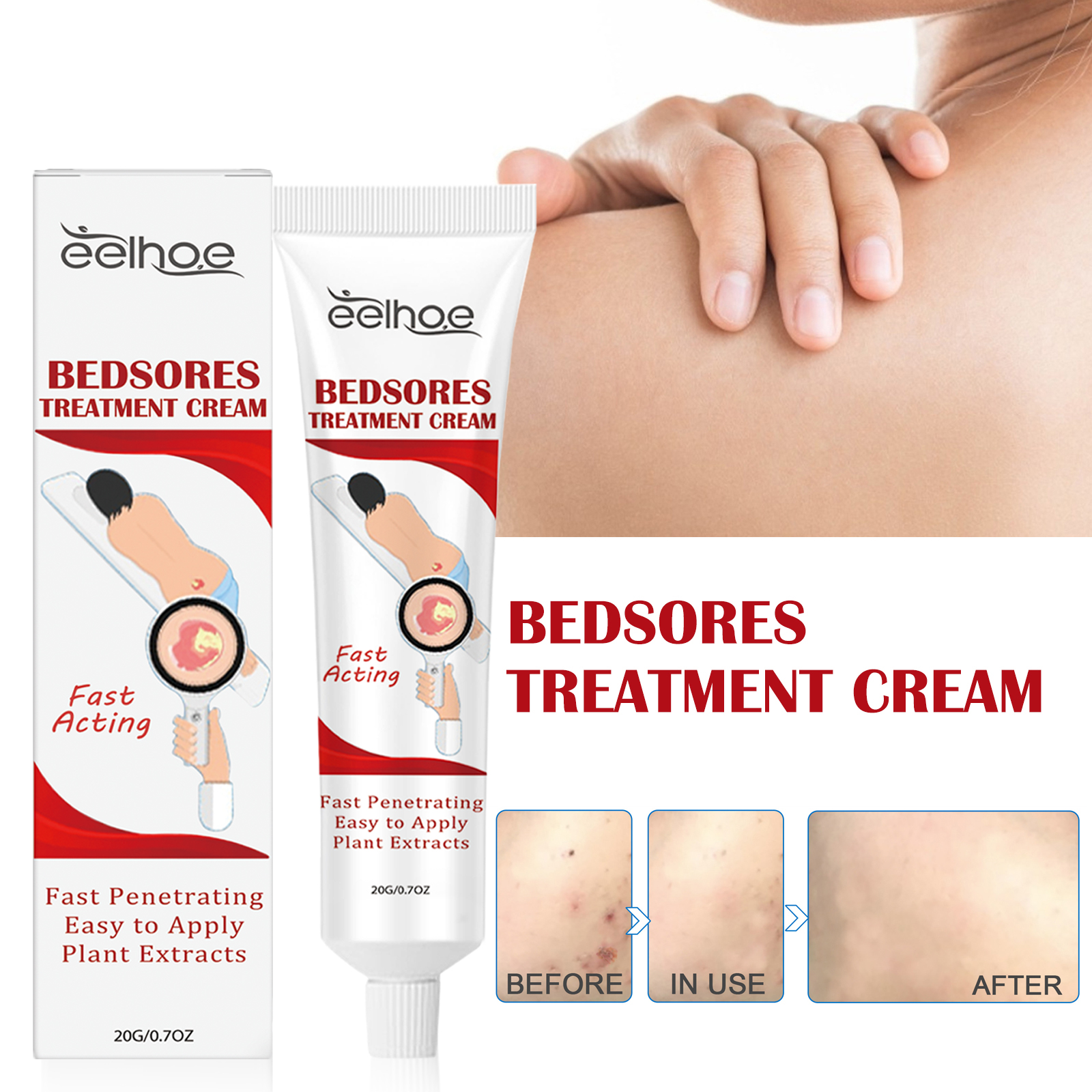 Skin Care Cream Soothing Moisturizing Barrier Support For Daily Body Skin Nourishment 20g