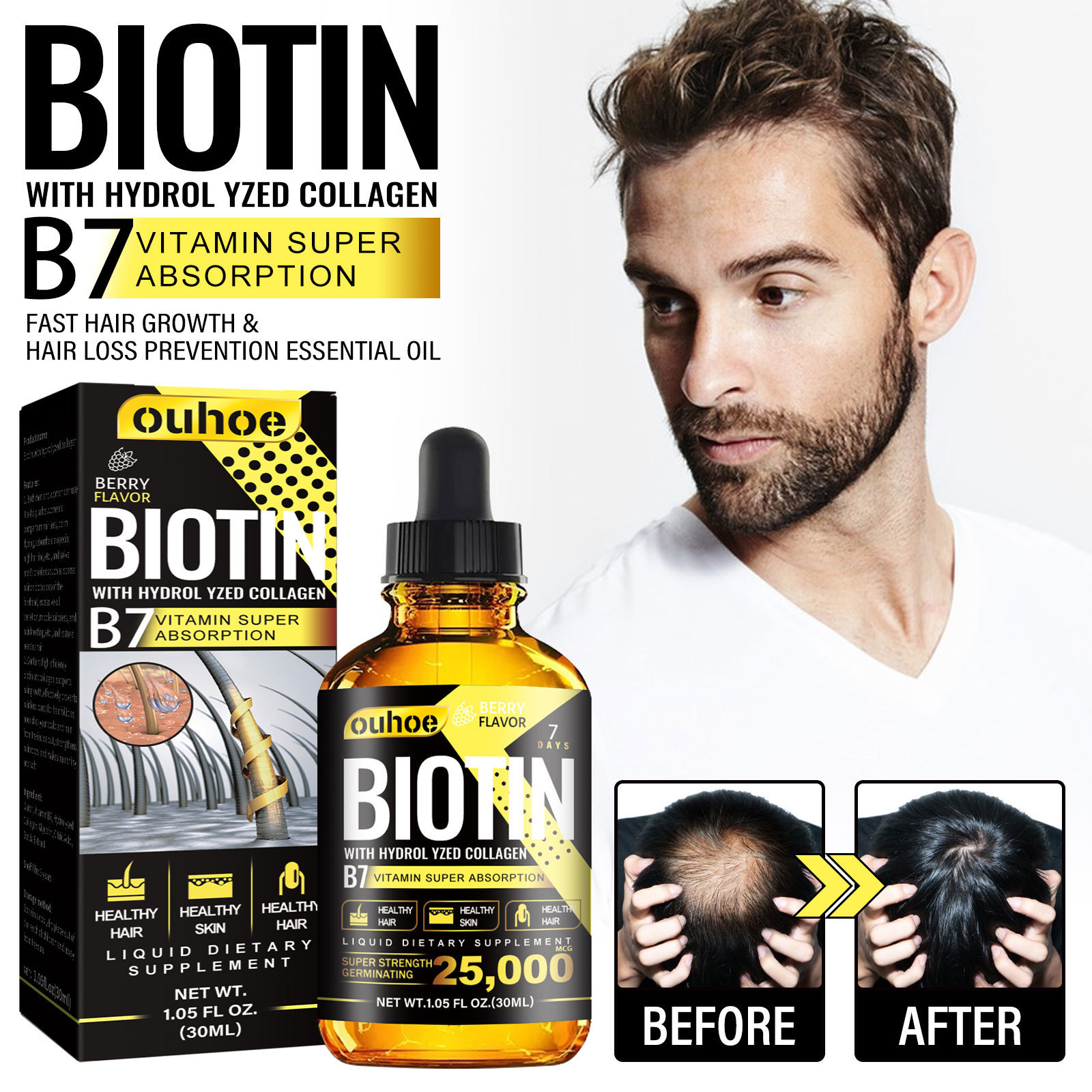 Biotin Oil Fast Hair Regrowth Serum Hair Essential Oil Hair Thinning Treatment Liquid Anti-hair Loss For Women Men 30ml