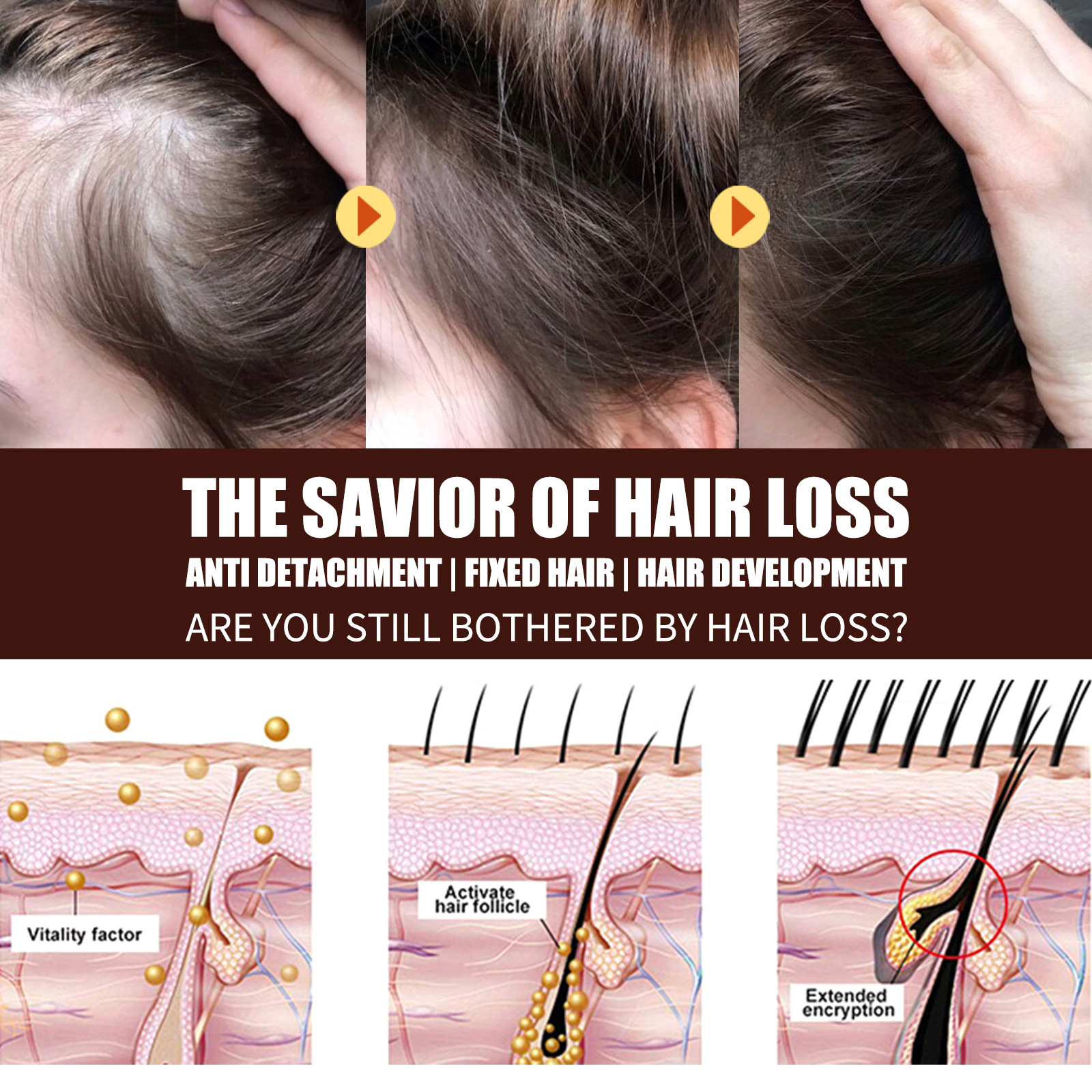 Rosemary Essential Oil Hair Growth Oils Pure Natural Hair Essential Oils For Anti Hair Loss Thicken Nourish Hair Scalp Care 30ml
