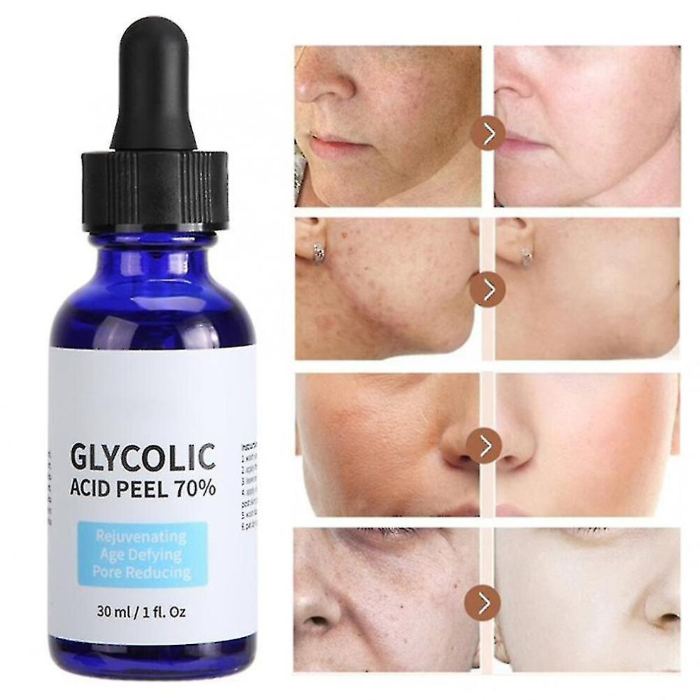 Glycolic Acid Peel Purity 70 Concentration 5 Skin Repair Invisible Pores Brighten Skin Tone Treat Acne Mild And Non-irritating-mxbc