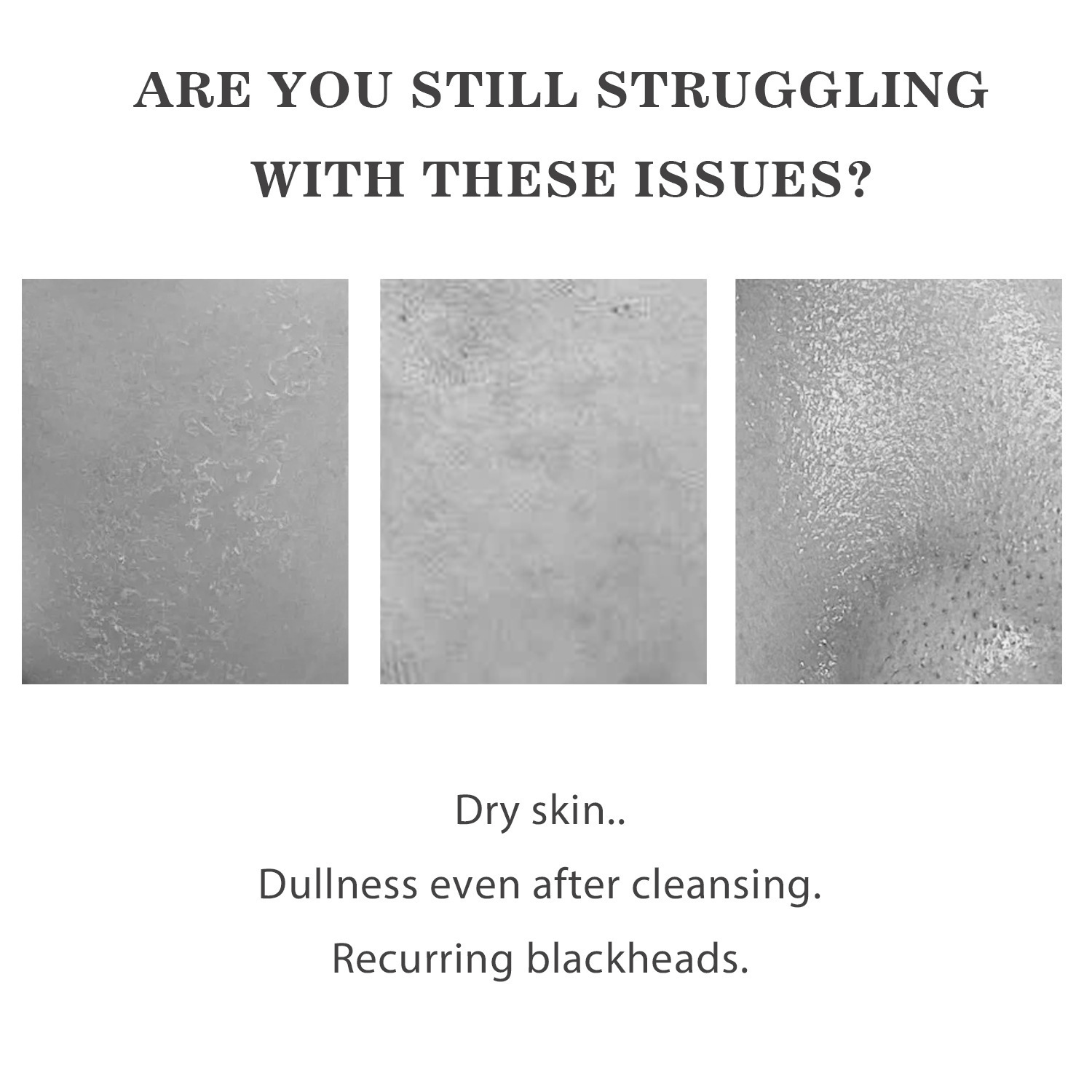 Rice Bran Water Niacinamide Ampoule Exfoliating Hydrating Brightening Daily Face Essence Serum