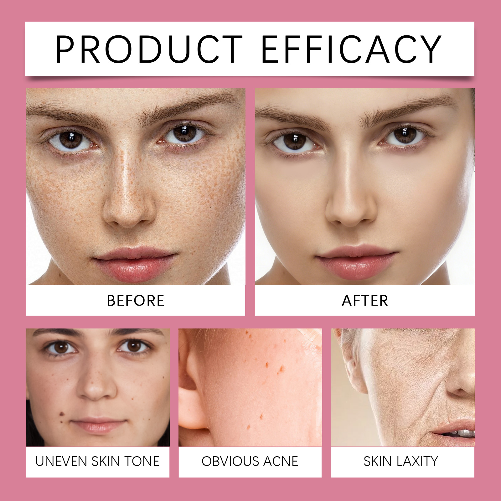 Nicotinamide Moisturizing Essence Liquid Hydrating Nourishing Refreshing Absorbable Soft Smooth Facial Skin Care Serum Product Gentle Massage